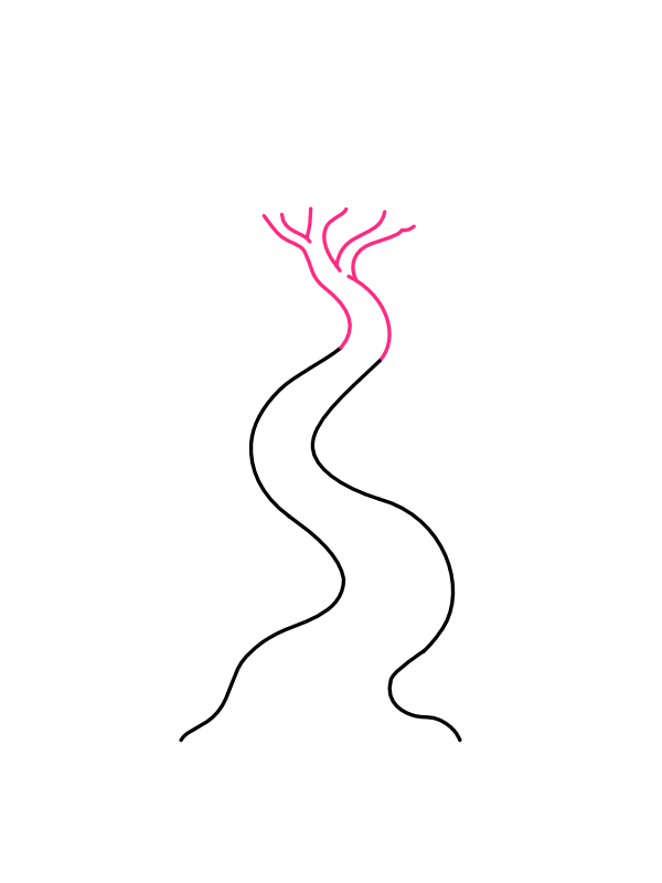Step 3: Split the Top into Branches